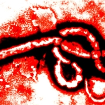 Are You Prepared for an Ebola Outbreak? Are You Prepared for an Ebola Outbreak?