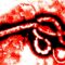 Are You Prepared for an Ebola Outbreak?